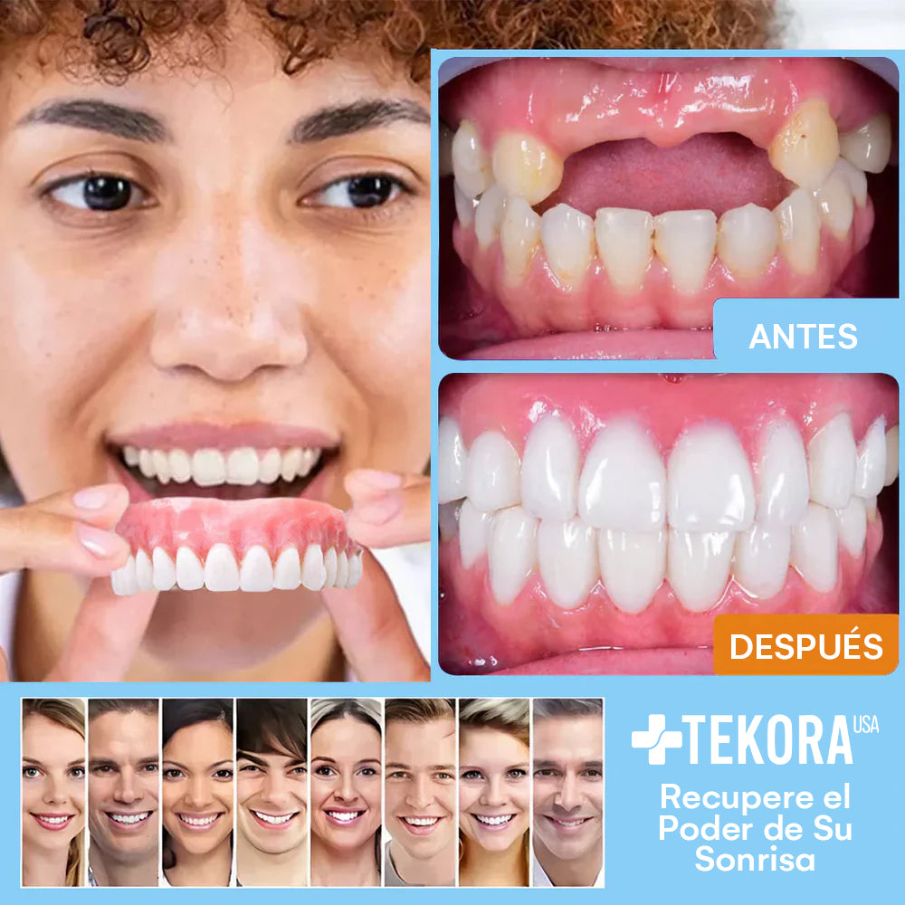DentureSet Pro | Set Completo de Dentaduras