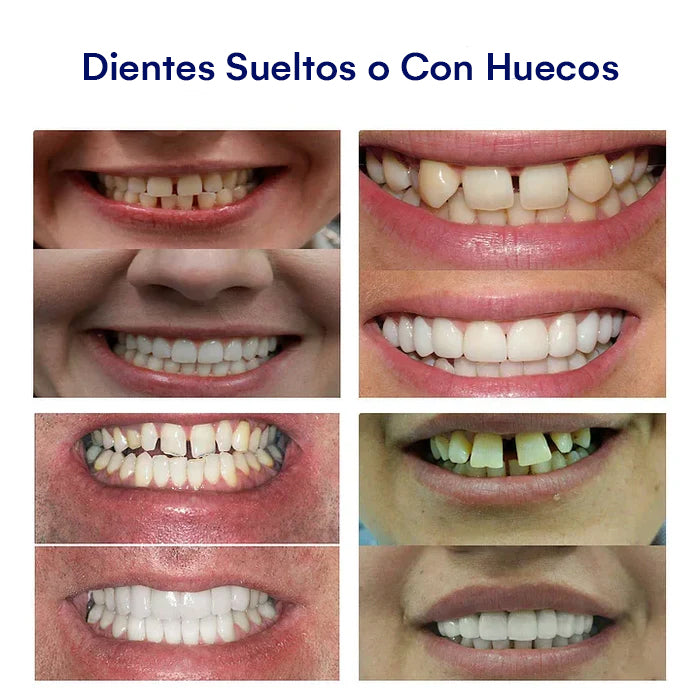 DentureSet Pro | Set Completo de Dentaduras